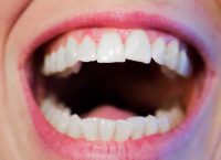 Comment lutter contre la mauvaise haleine ?